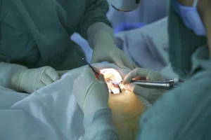 Phẫu thuật Phaco